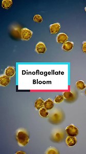 Observing Freshwater Golden Dinoflagellates Under Microscope