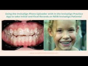 How to Use the Invisalign Photo Uploader/Invisalign Practice App to take Photos on Braces Patients
