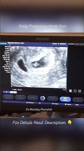 Baby Heart Rate in 2nd Month Of Pregnancy on Ultrasound Scan