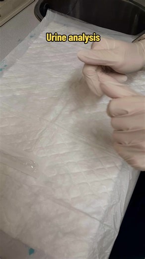 Urine sediment analysis Our nurse's perform this test to check for various artifacts, including urine crystals. Take a look at what we do and how we do it 👀🔬 #rhydbroughton rhyd.socials