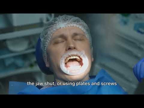 Mandibular fractures