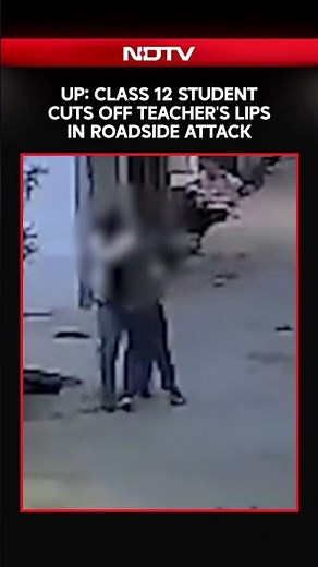 Class 12 Student Cuts Off Teacher's Lips In Roadside Attack In UP