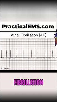Atrial Fibrillation Explained: Irregular Heartbeat Explained Simply! #shorts