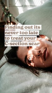 C-section scar massage- can improve the appearance of your scar and overhang- can reduce pain, pulling and tightness around the abdomen and pelvis- can improve pelvic floor function- can improve digestive and gut issues- can help to support fertility later on- can improve numbess or itching that sometimes occurs for years after c-section- can still do all of these things even if you start years after your csection birth⠀⠀⠀⠀⠀⠀⠀⠀⠀For more info about treating your csection scar and overhang go to o