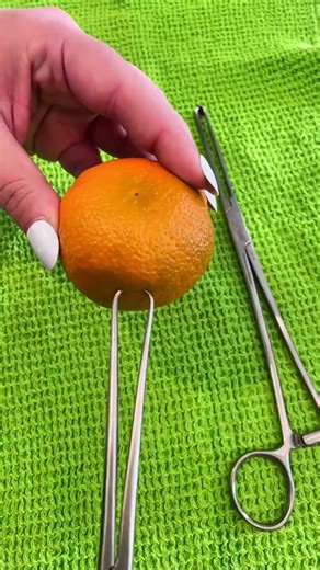 A tenaculum is a tool used to grasp tbe cervix #womenshealth #obgyn #femininehealth #iud