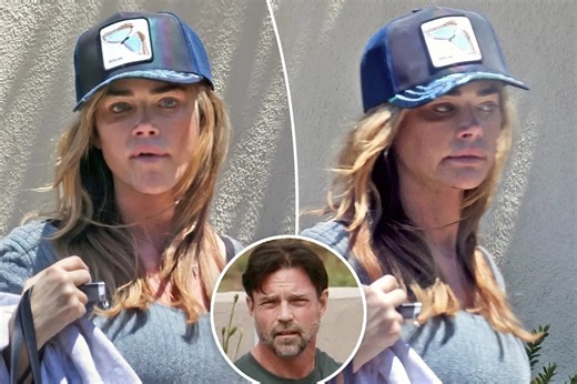 Denise Richards seen with black eye days after estranged husband Aaron Phypers called cops