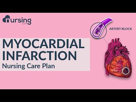 How to care for Myocardial Infarction as a nurse... Nursing Care Plan