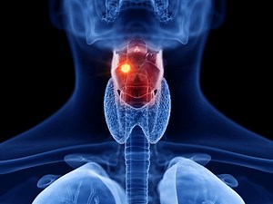 Cancer ORL (tête et cou) : symptômes, incidence, traitements