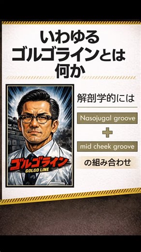 町田 志樹【解剖学・医学博士】 on Instagram: "美容領域でよく使われる「ゴルゴライン」。 目頭の下から頬の中央にかけて、斜めに走る溝やへこみを指します。 ただし⚠️ゴルゴラインは解剖学用語ではありません。 解剖学的には ▶ Nasojugal groove ▶ mid cheek groove これらを『包括した見た目のライン』として語られることが多いのです。 「名前」と「構造」を分けて理解することが、美容解剖の第一歩です👨‍🏫 #ゴルゴライン #美容解剖学 #顔面解剖 #エイジングケア #美容医療 解剖学"