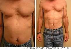 Bizarre Plastic Surgery