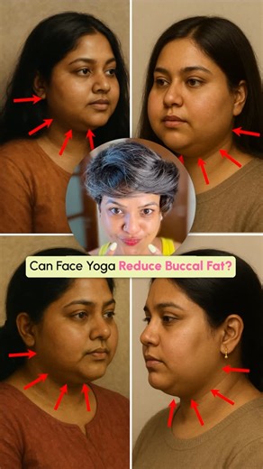 Garima✨India's First Facial Reflexology x Face Yoga Expert | ✨ How to get rid of buccal fat naturally? Here’s all you need to know ⬇️ ❓ What is Buccal Fat? Buccal fat is the natural fat between your... | Instagram