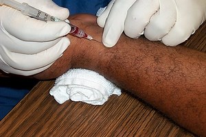 What Is an Arterial Blood Gas Test (ABG)? - Intensive Care Hotline