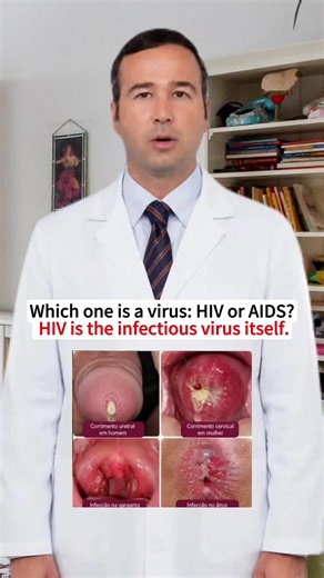 Curious about HIV vs AIDS? 🤔 Learn how HIV (human immunodeficiency virus) can lead to AIDS if untreated. Discover the importance of T-cell counts and how effective treatments are reversing AIDS today! Share your thoughts in the comments! 💬 #HIV #AIDS #HealthEducation #Immunology #MedicalFacts