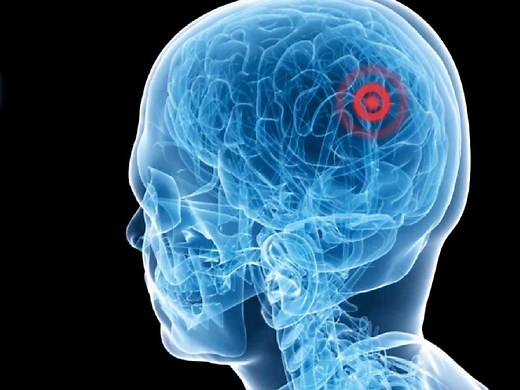 Ultrasound surgery -- healing without cuts