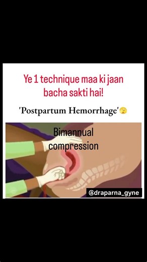 Delivery ke baad agar bleeding ruk hi na rahi ho… to ye 1 technique maa ki jaan bacha sakti hai!