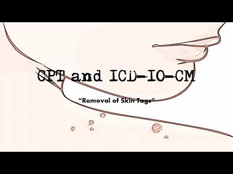Easy to Code CPT & ICD 10 CM for the Removal of Skin Tags