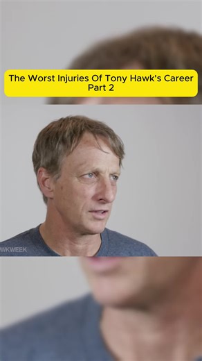 The Worst Injuries Of Tony Hawk's Career - Part 2 #skateboarding #tonyhawk #injury #career