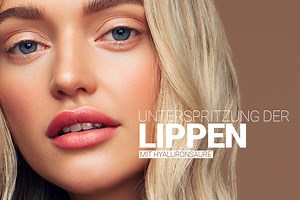 Lippen aufspritzen mit Hyaluron | Lippenunterspritzung bei M1 Zürich