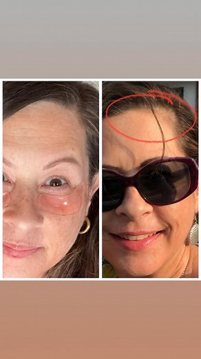 🌿✨ These are people's BEFORE & AFTER pictures with MONAT! ✨🌿 I can’t even begin to tell you how much of a difference these products have made for my hair and scalp! 💆‍♀️💖 When I first started, my hair was dry, dull, and lifeless — no shine, no bounce, and constant frizz. 😩 Fast forward to NOW… it’s soft, shiny, healthy, and growing faster than ever! 🌱🙌 MONAT’s naturally based ingredients work from the scalp up — nourishing, strengthening, and bringing your hair back to life strand by stra