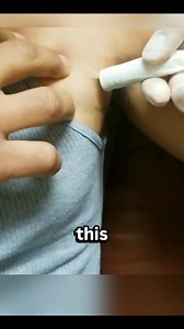 Removing Metal from the Body Using a Magnet #usatoday #usareels #bussiness #usa_tiktok #SmartNature | Mr.mee100