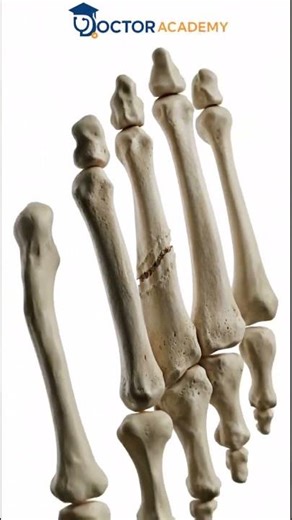 Stress Fractures of the Foot Explained #shortvideo #shorts #science #short