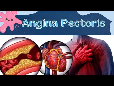 ANGINA PECTORIS – Causes, Symptoms, Types, Diagnosis & Nursing Management | Easy Explanation