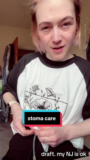 Stoma Care Routine: Cleaning and Maintenance Tips