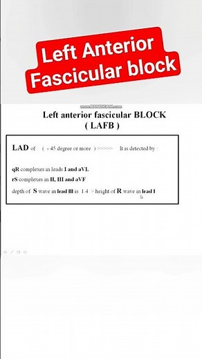 ECG features of Left Anterior Fascicular block #ecg