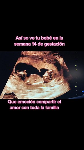 Ecografía de tu bebé en la semana 14 de gestación