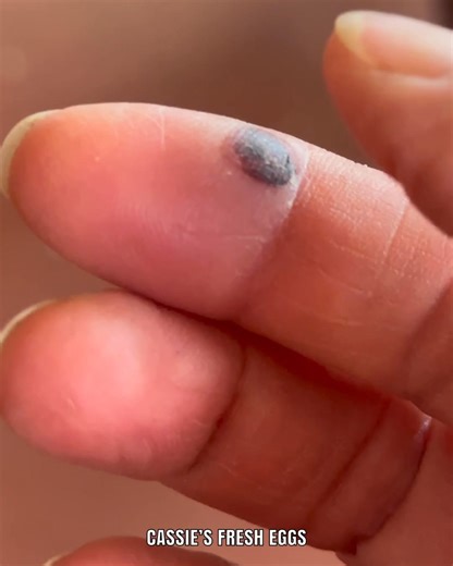 When I was making bird feeders I pinched my finger badly. It’s so swollen and painful. It killed me trying to spray deodorant this morning. Back to work Monday and I need to use a mouse 😳 | Cassie's Fresh Eggs