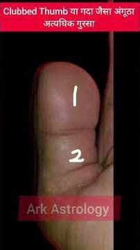 Clubbed Thumb|Palmistry|Astrology#ytshorts#viralshorts#viral #shorts#youtubeshorts#palmistry