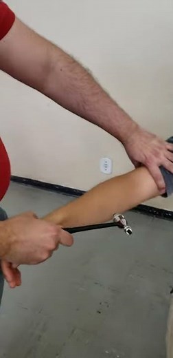 Reflexo braquiorradial