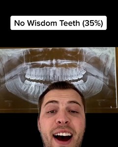 576K views · 3.1K reactions | Okay but does anyone really like cilantro? (@knowledgesaurus on Insta and TikTok) | BuzzFeed Video | Facebook