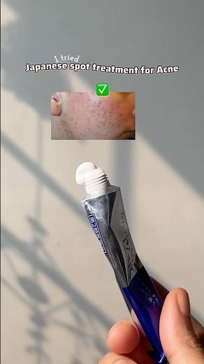 I tried viral Japanese pimple treatment ✨ #skincare