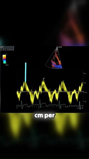 🎯 The RV S′ Velocity Cutoff for Normal Function