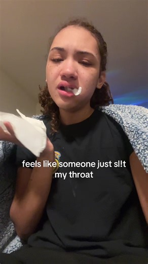 the pain is just getting worse #fyp #wisdomteethremoval #crying