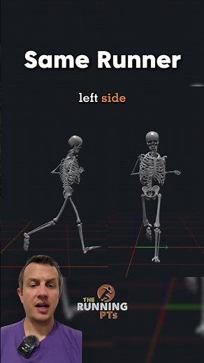 3D Gait Analysis Breakdown. 𝗟𝗲𝗳𝘁 𝗛𝗶𝗽 𝗣𝗮𝗶𝗻