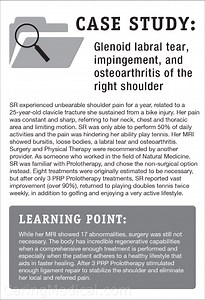 Shoulder pain injections | Comparing PRP, Cortisone and Prolotherapy