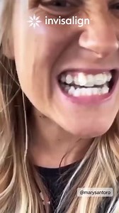 Invisalign on Instagram: "Invis is when everything clicks. And now you'll have the confidence to make any first impression... impressive. Getting a new smile is more affordable than you think. Many insurance plans cover Invisalign and many doctors offer flexible payment options, some even with low to no down payment."