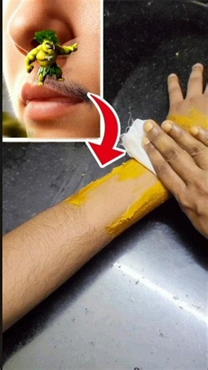 👉3 பொருள் சேர்த்த Best natural Hair removal facepack👌 #skincare #beauty #shorts #glowingskin #viral