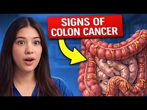 Early Warning Signs Of Colon Cancer You Should NOT IGNORE: Doctor Explains
