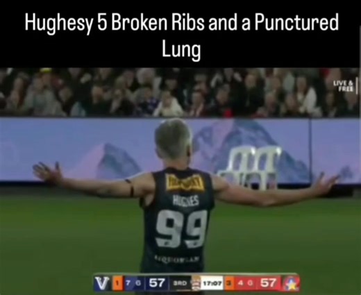 Nailed by Robinson. #afl #legends #game #allstars #vic #davehughes #sports | AFL Hits and Biffs