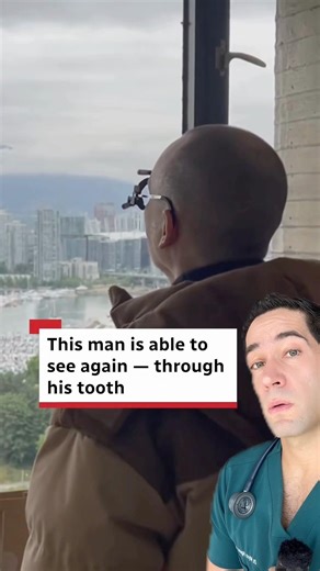 Doctor Reacts: he sees through his tooth?!