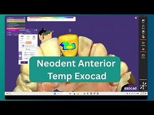 Neodent Anterior Temp Exocad