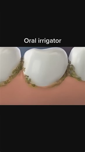 Weight Loss | Home Workout 🇺🇸 on Instagram: "Using a dental water jet can effectively remove food debris between teeth 💥 👉🏻 Get your now 🛒 : LINK IN BIO @happyhomeworkout . . . #waterflosser #waterflossing #badbreath #badbreathtreatment #Oralhealth #Dental #Dentalhygiene #Floss #Oralirrigator #Oralhygiene #waterfloss #oralhygiene #teethwhitening #badbreath #usa #newyorkcity #bracestips #gingivitis #deepclean #tonsilstones #whitetongue #braces #mouthwash #takecareofyourteeth #newyork"