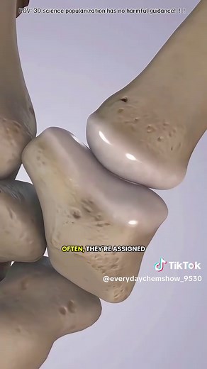 Finger Joint Replacement Surgery #pipjoint #fingerjoint #fingersurgery #fingerarthritis #fingerjointreplacement