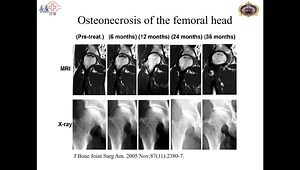Extracorporeal Shockwave Technology (ESWT) for Orthopaedic Treatment