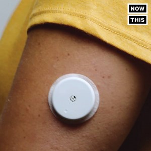 1.7M views · 9.2K reactions | This device can check your blood sugar – without a needle | NowThis Earth | Facebook