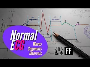 ECG Pattern made easy; Importance of P QRS T & U Wave, PR & ST Segment, PR QRS QT ST RR PP Interval