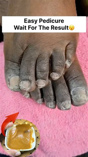 Fair Feet Tips | Clean Hand Dirt & Tanning/Most Easy Pedicure & Manicure #pedicure #manicure #shorts